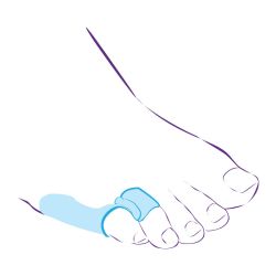 СТ-52.2 Перегородка межпальцевая с протектором,совмещенная с протектором сустава