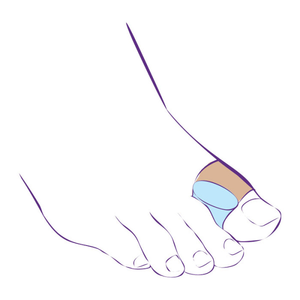 Перегородка межпальцевая с петлей на первый палец стопы на тканевой основе СТ-54.5  Trives