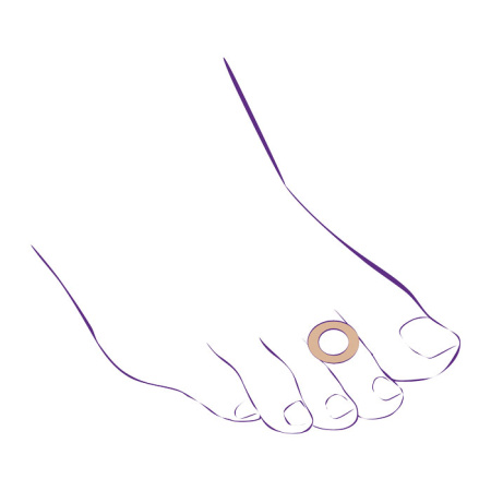 Протектор-кольцо от мозолей СТ-63  Trives